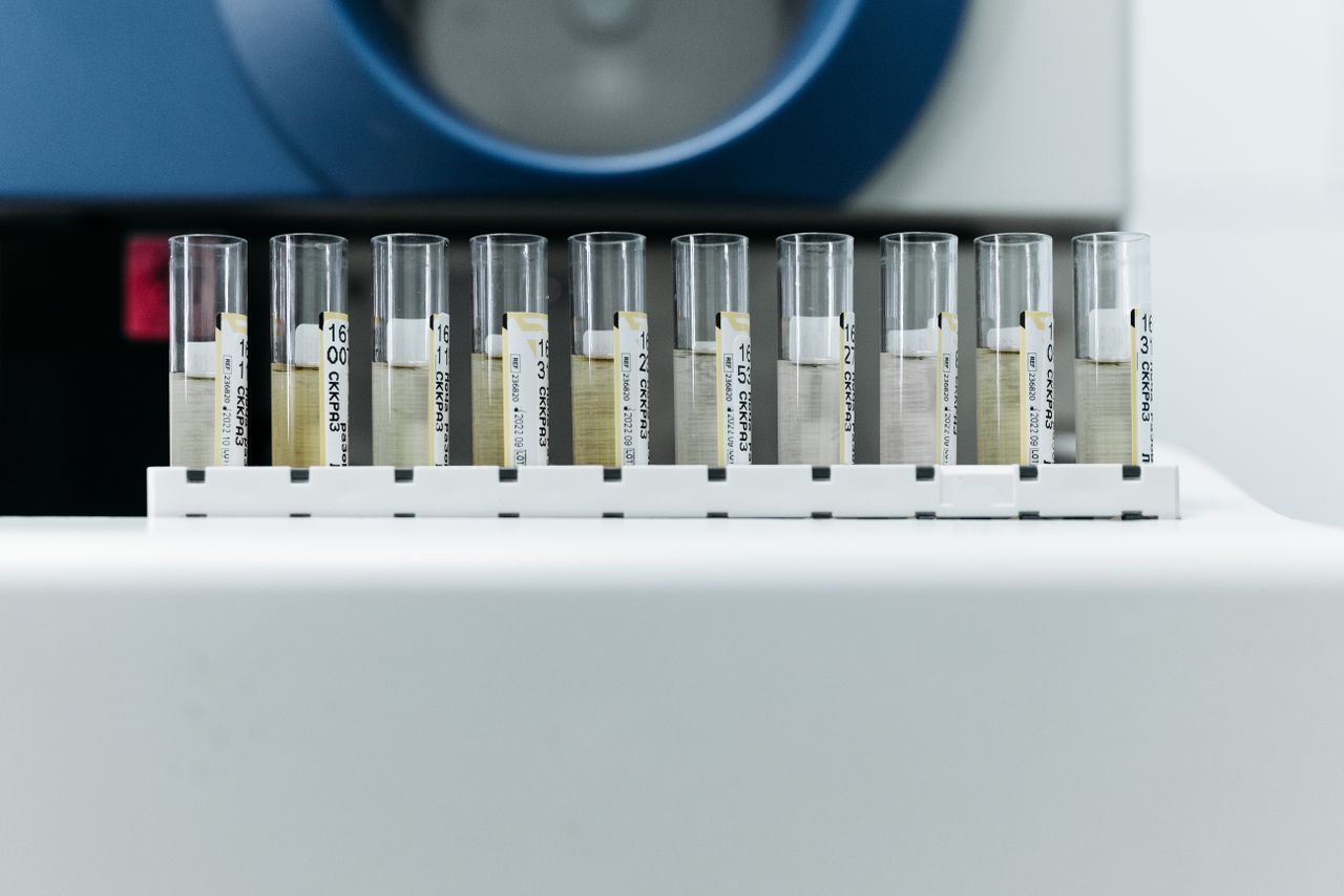 Row of labelled test tubes on a rack