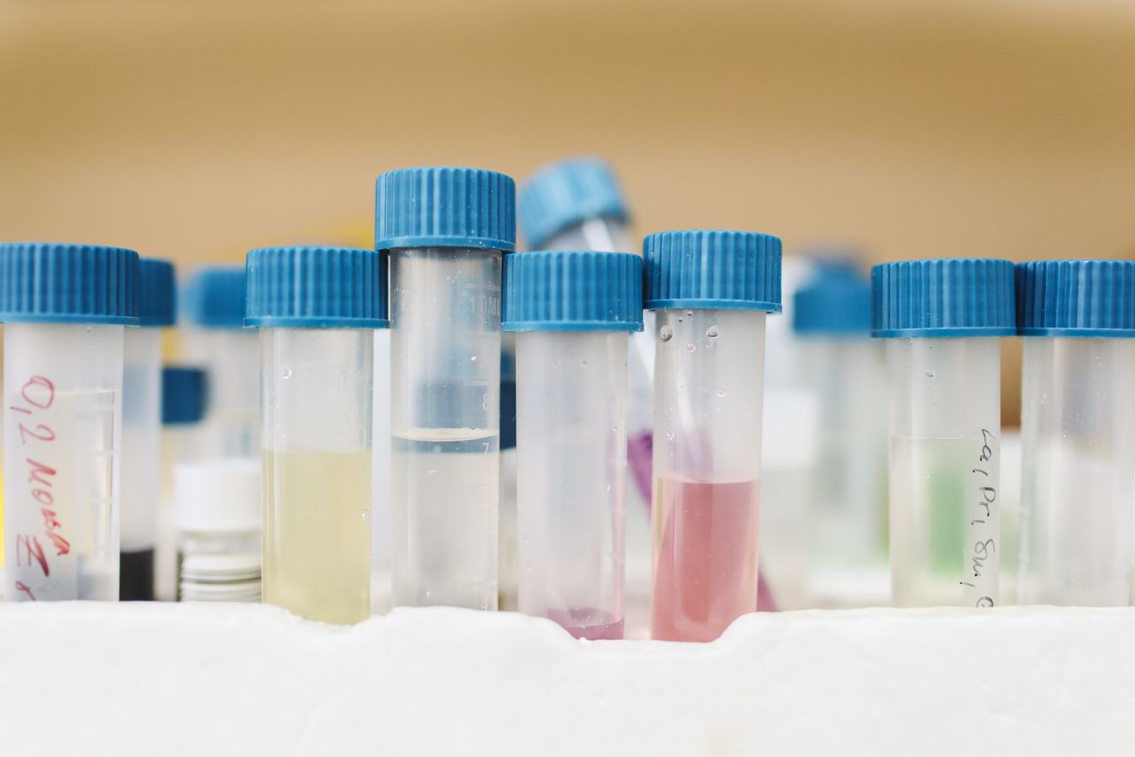 Colourful test tubes with blue caps in a laboratory