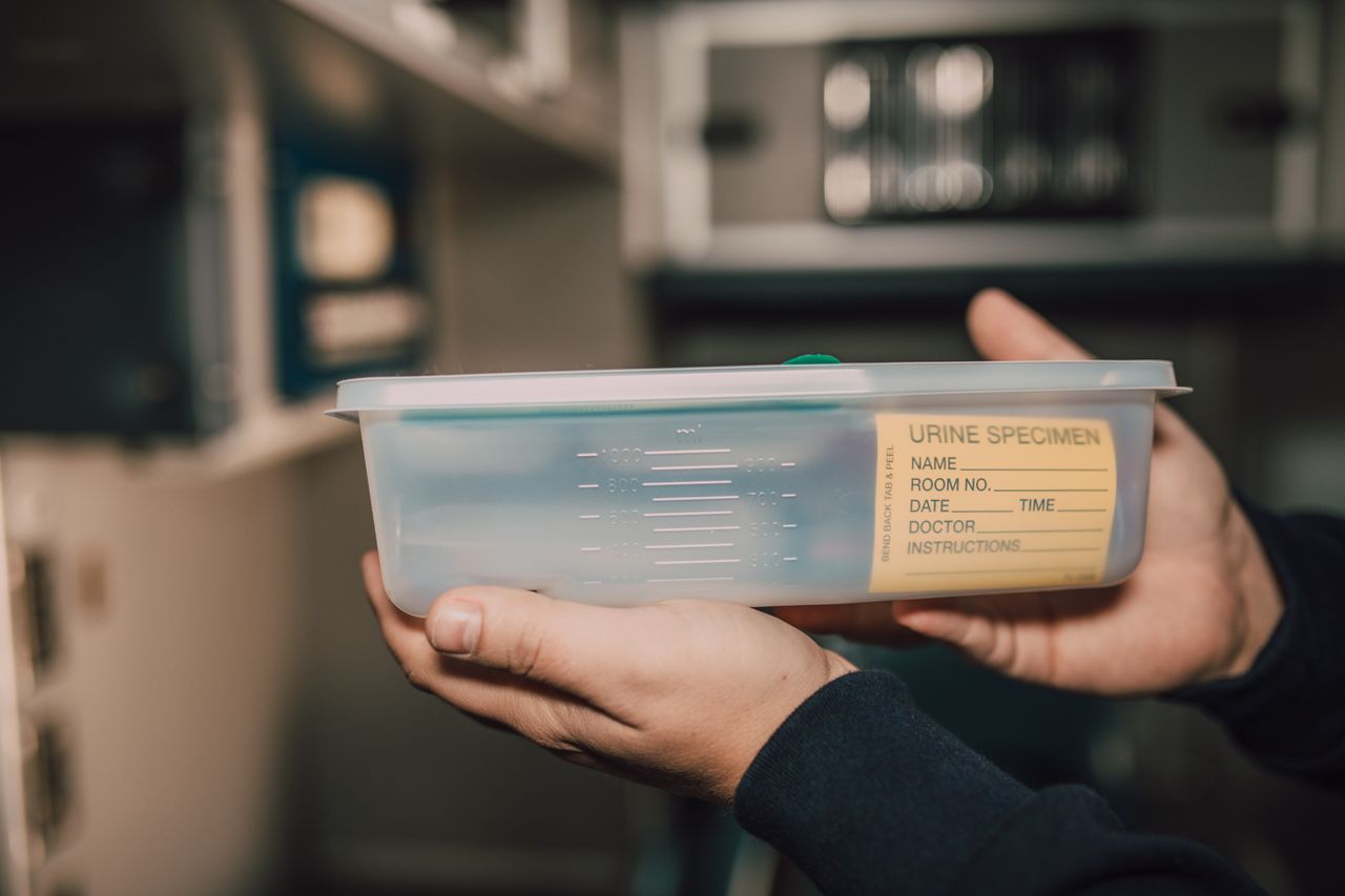 Hands holding a urine specimen container in a laboratory