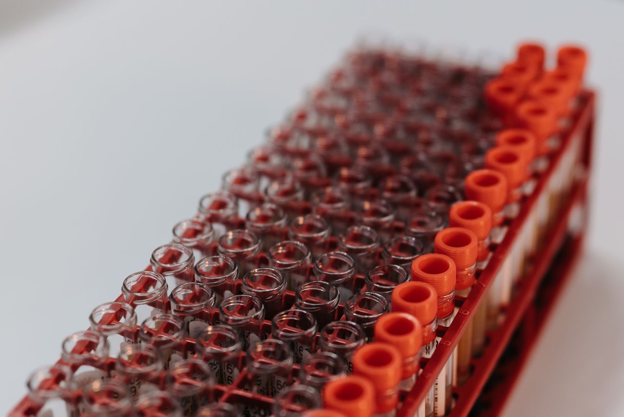 Laboratory test tubes in a rack