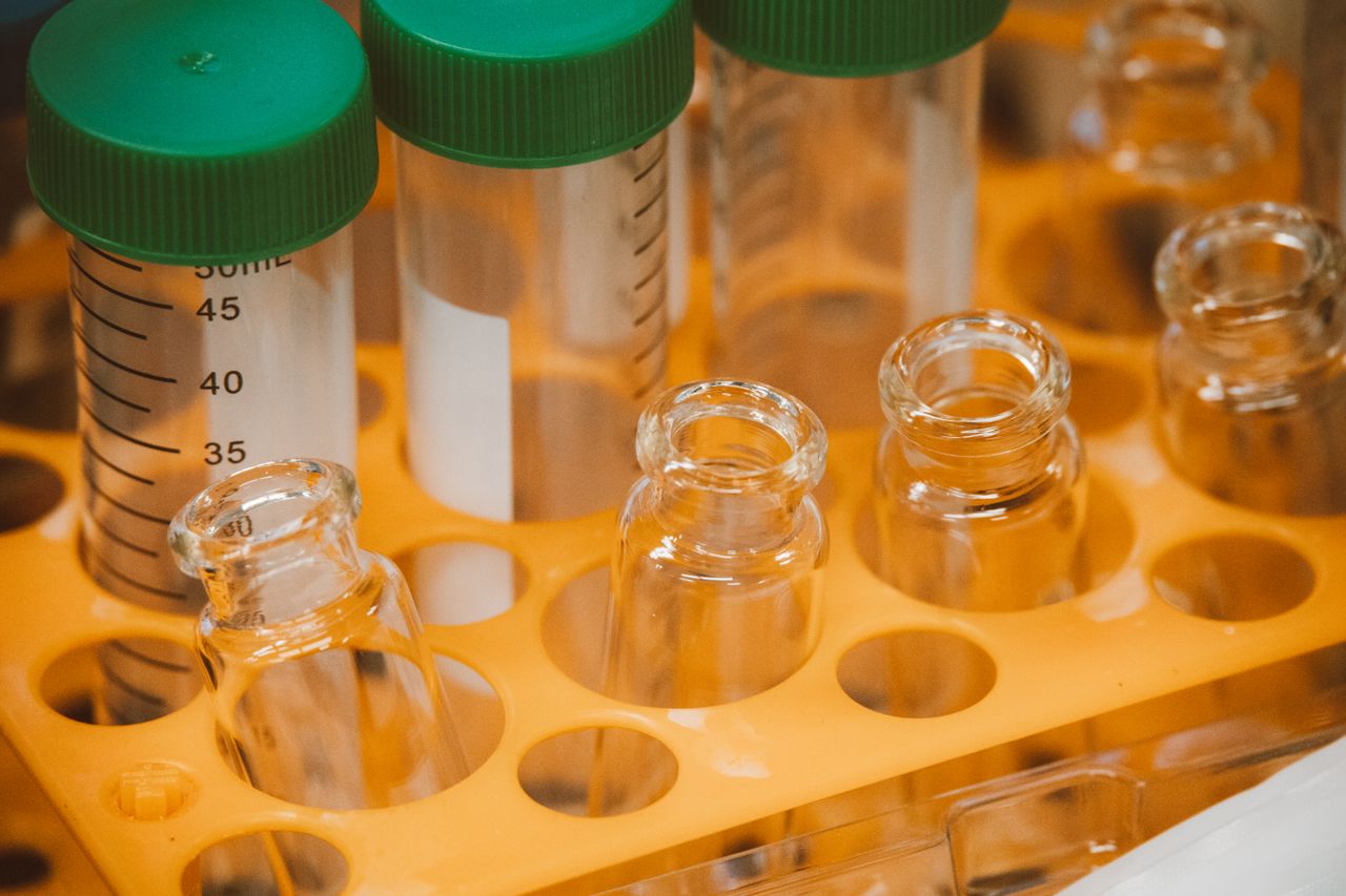 Laboratory test tubes in an orange rack